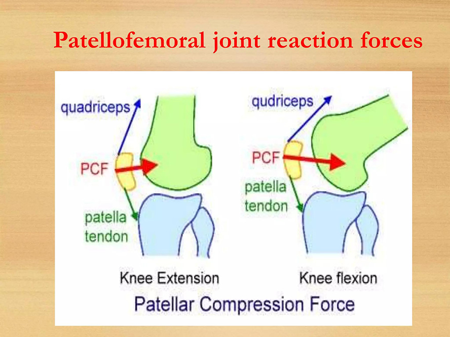 Knee joint biomechanics diagram showing patella movement and stress distribution during sports activity